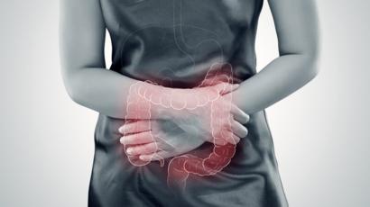 Sindrome de Intestino Irritable