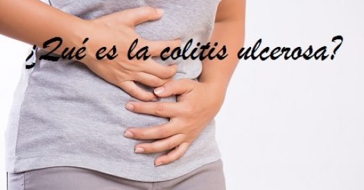 Colitis ulcerosa2