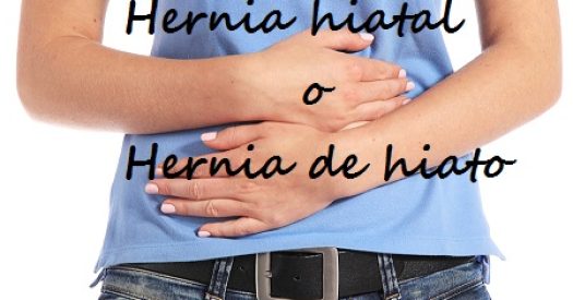 Hernia Hiatal